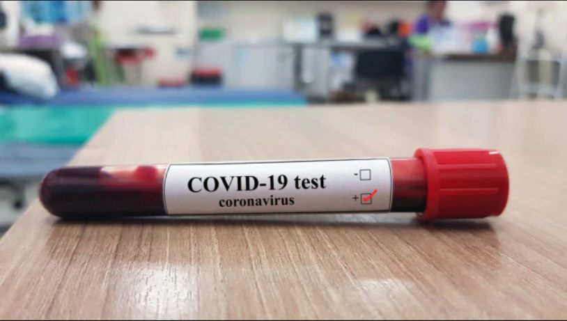 coronavirus test